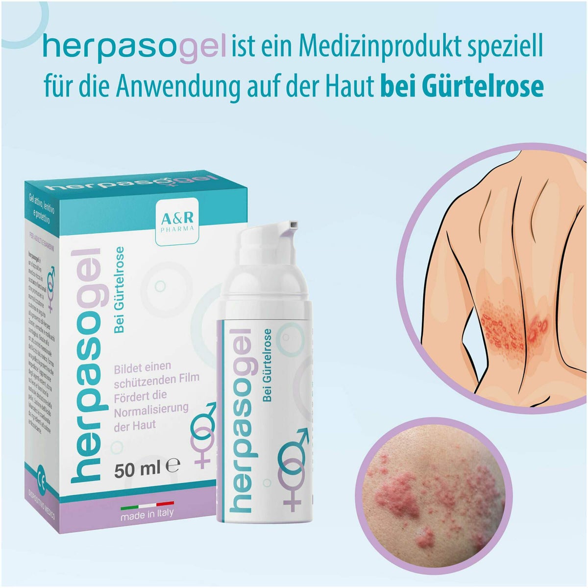 Herpasogel bei Gürtelrose 50 ml