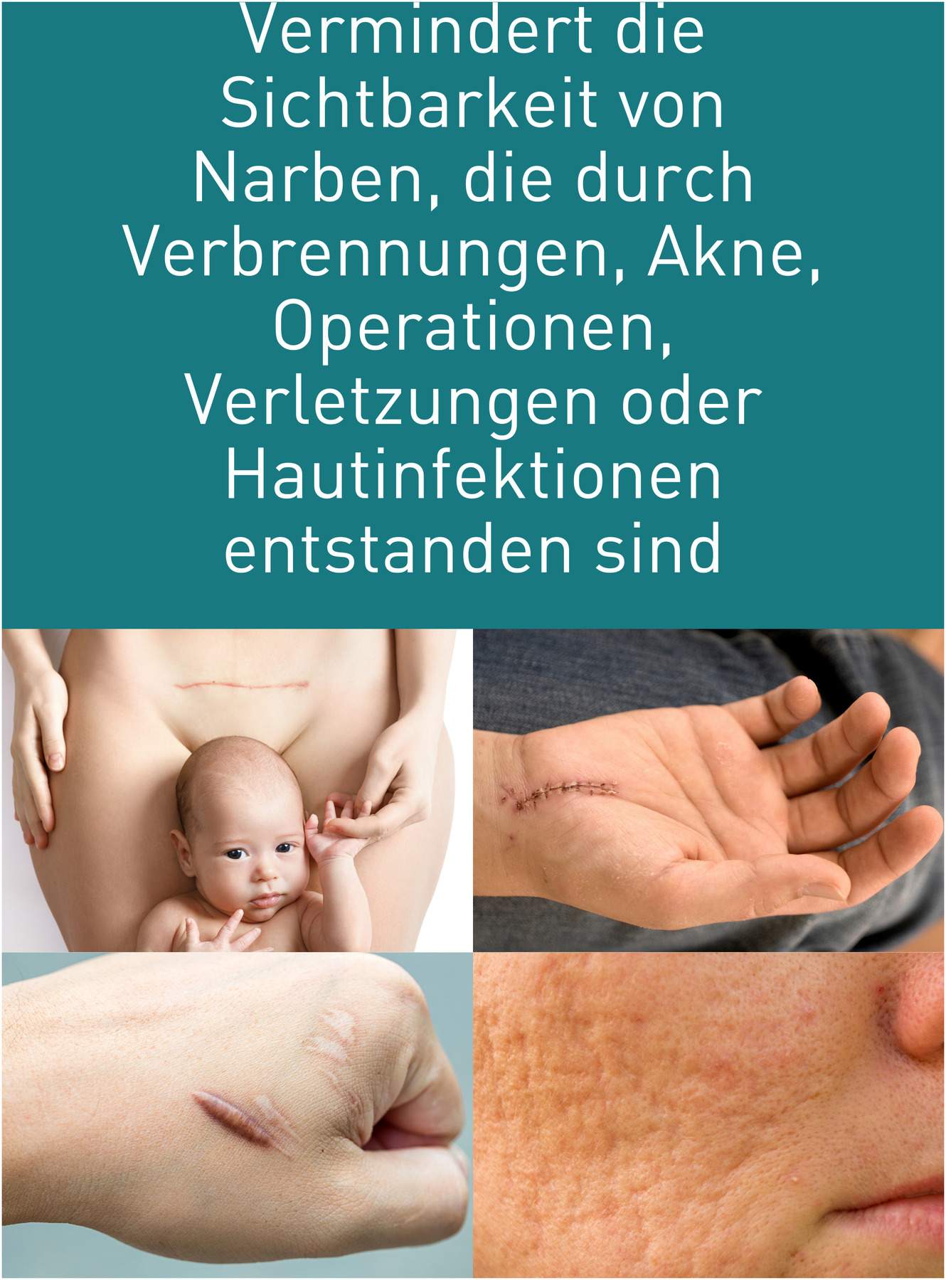 N1 Narben Gel 19 G
