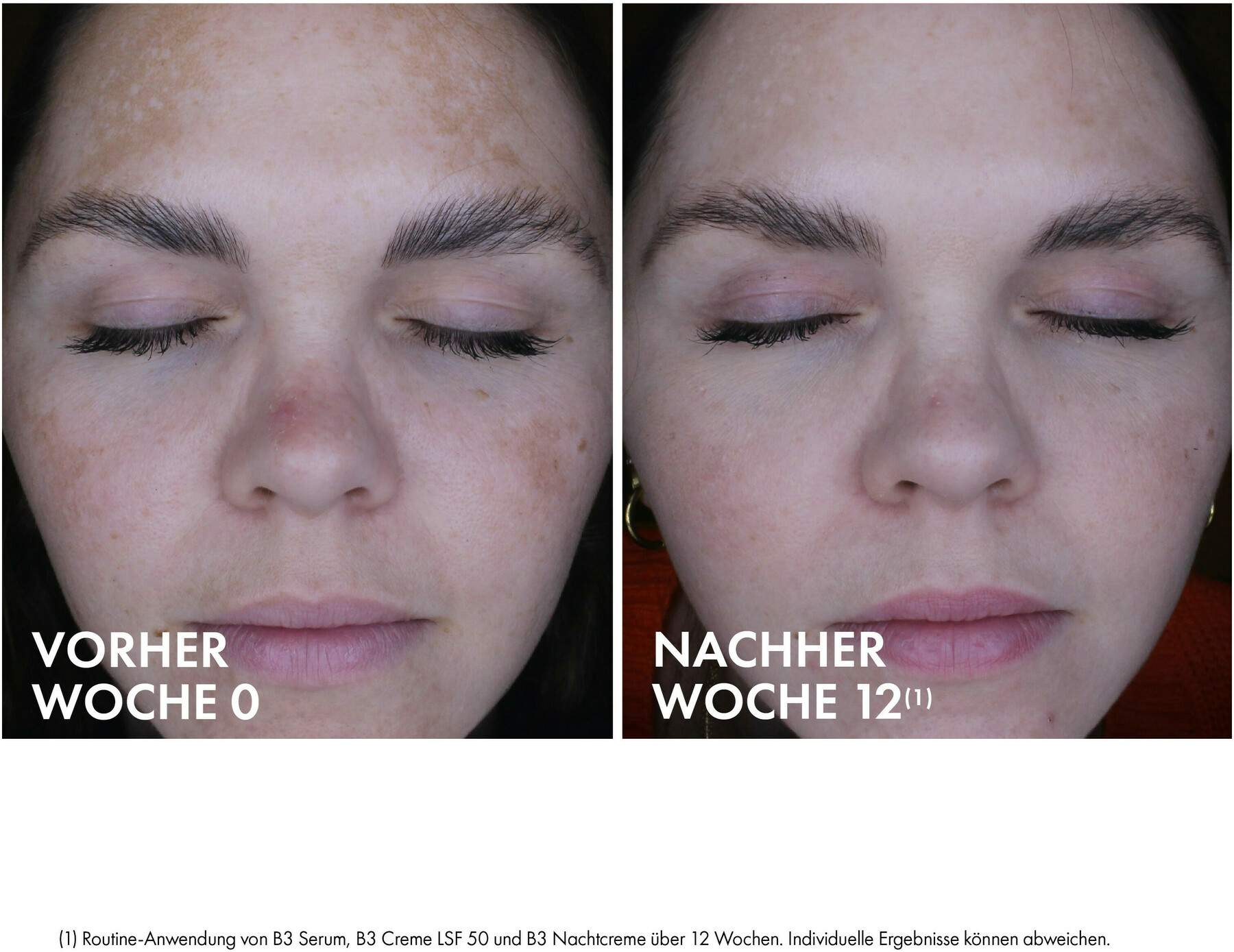 Vichy Liftactiv B3 Retinol Nachtcreme 50 ml
