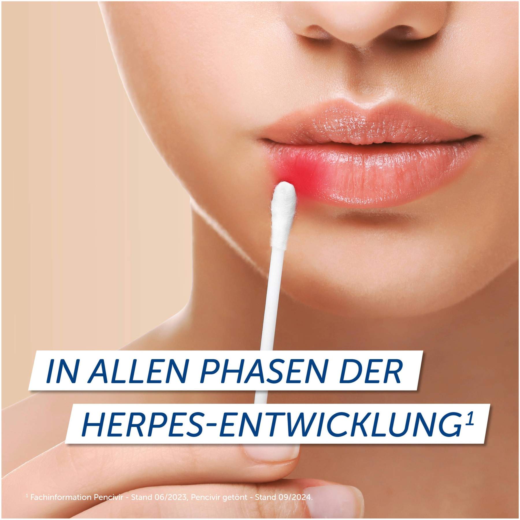 Pencivir bei Lippenherpes 2 g Creme