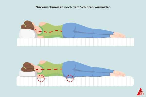 Eine Illustration wie man am besten liegt, damit man Nackenschmerzen nach dem Aufwachen vermeidet. Die Wirbelsäule sollte gerade ausgerichtet sein und der Kopf weder zu hoch noch zu tief gelagert werden. Außerdem sollte sich die Matratze der Körperform anpassen.