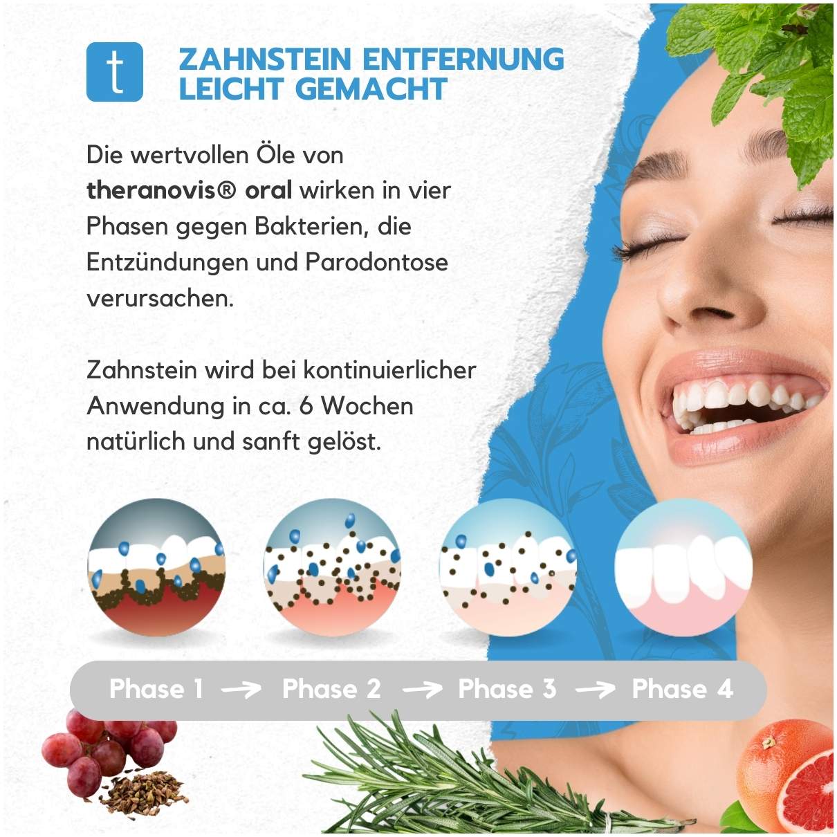 Theranovis Zahnstein Spray 65 ml