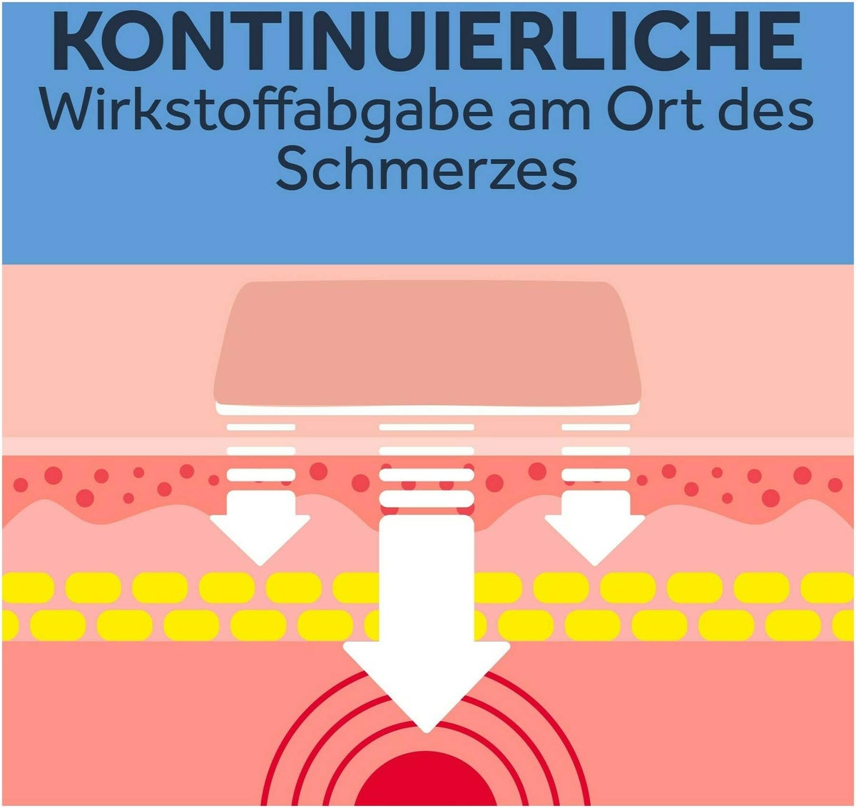 Nurofen 24-Stunden Schmerzpflaster 200 mg 8 Stück