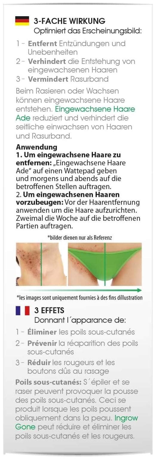 Biomed Eingewachsene Haare Ade 90 ml Creme