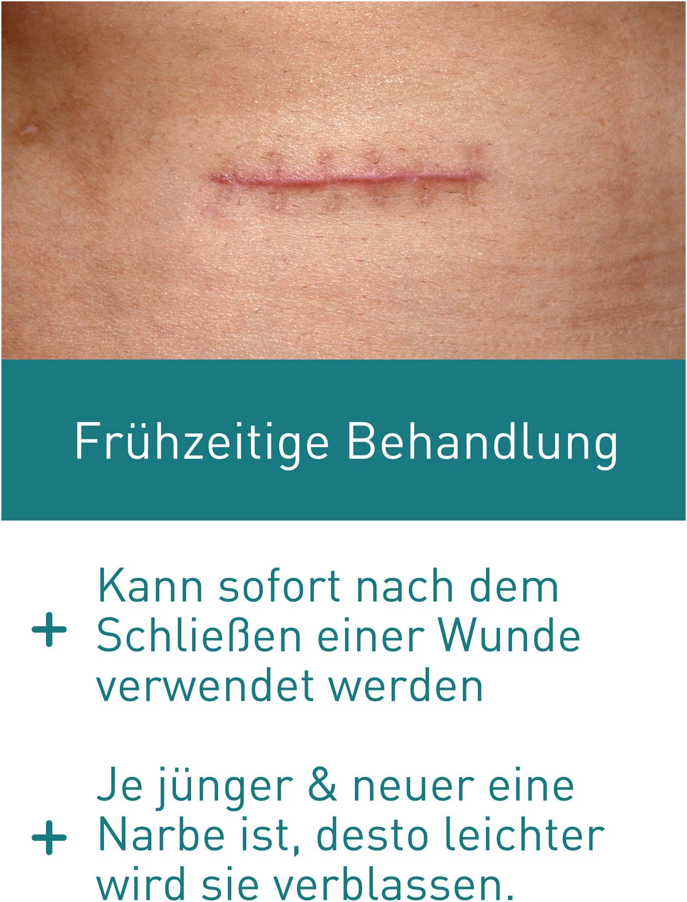 N1 Narben Gel 19 G