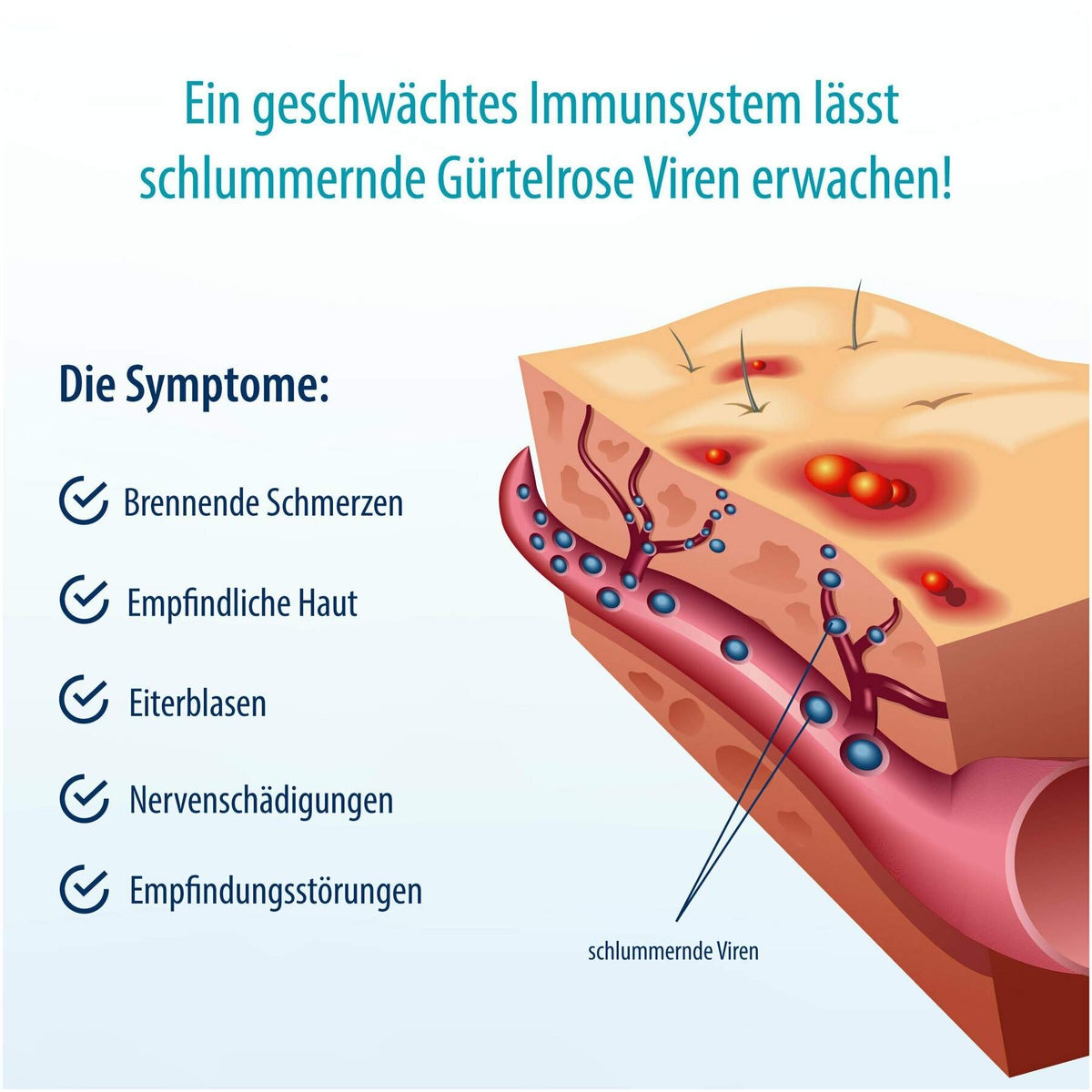 Herpasogel bei Gürtelrose 50 ml