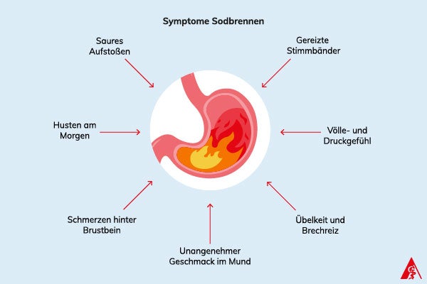 Symptome Sodbrennen Eine Illustration der Symptome von Sodbrennen. Dazu gehören: Gereizte Stimmbänder, Völle- und Druckgefühl, Übelkeit und Brechreiz, ein unangenehmer Geschmack im Mund, Schmerzen hinter dem Brustbein, Husten am Morgen sowie saures Aufstoßen