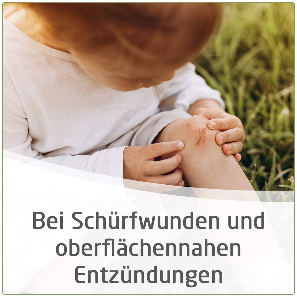 Weleda Calendula Wundsalbe 25 G