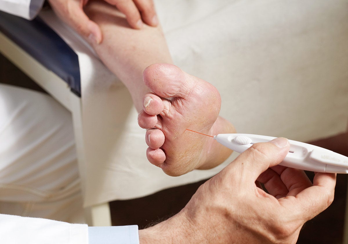 Diabetische Polyneuropathie: Ursachen, Diagnostik und Behandlung