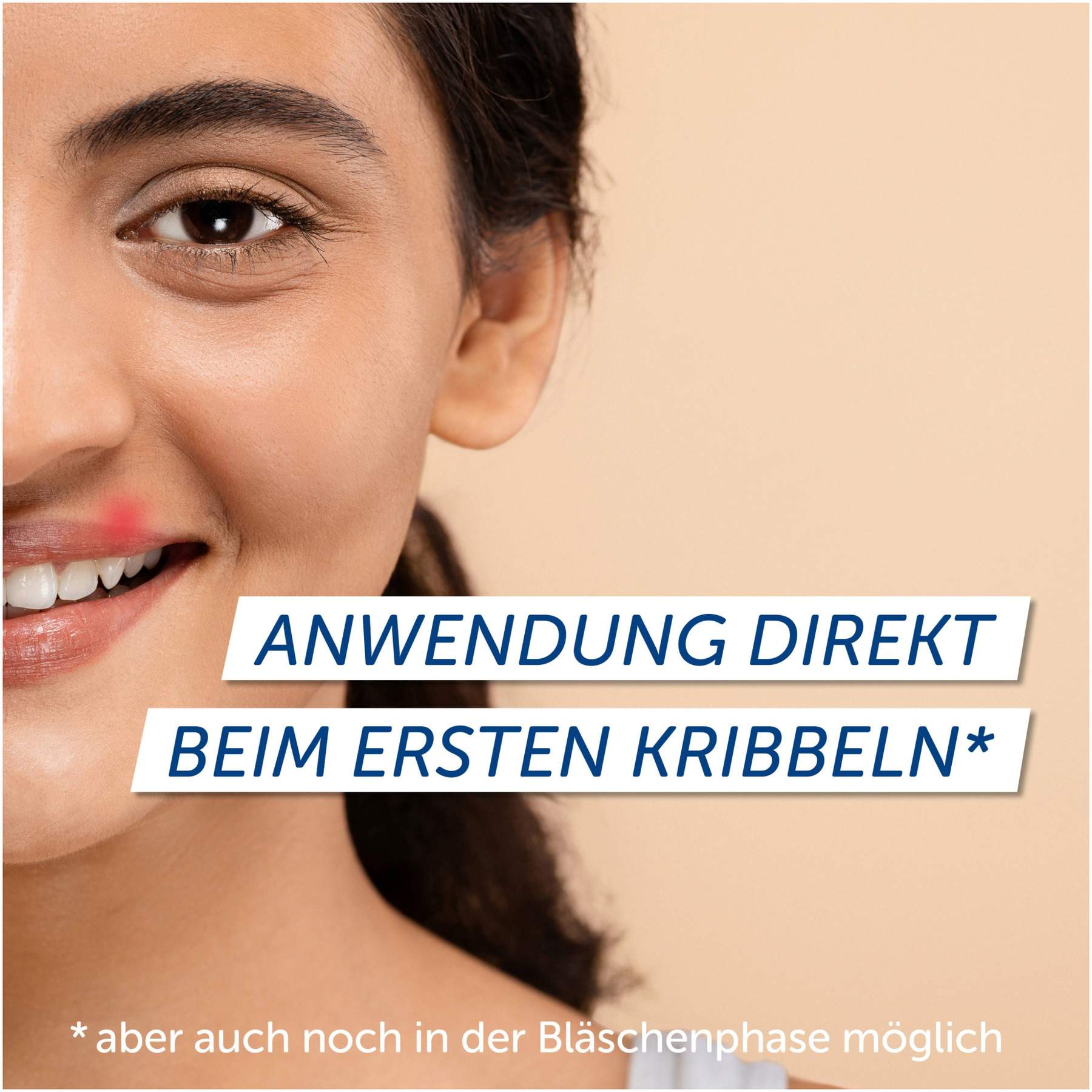 Pencivir bei Lippenherpes 2 g Creme