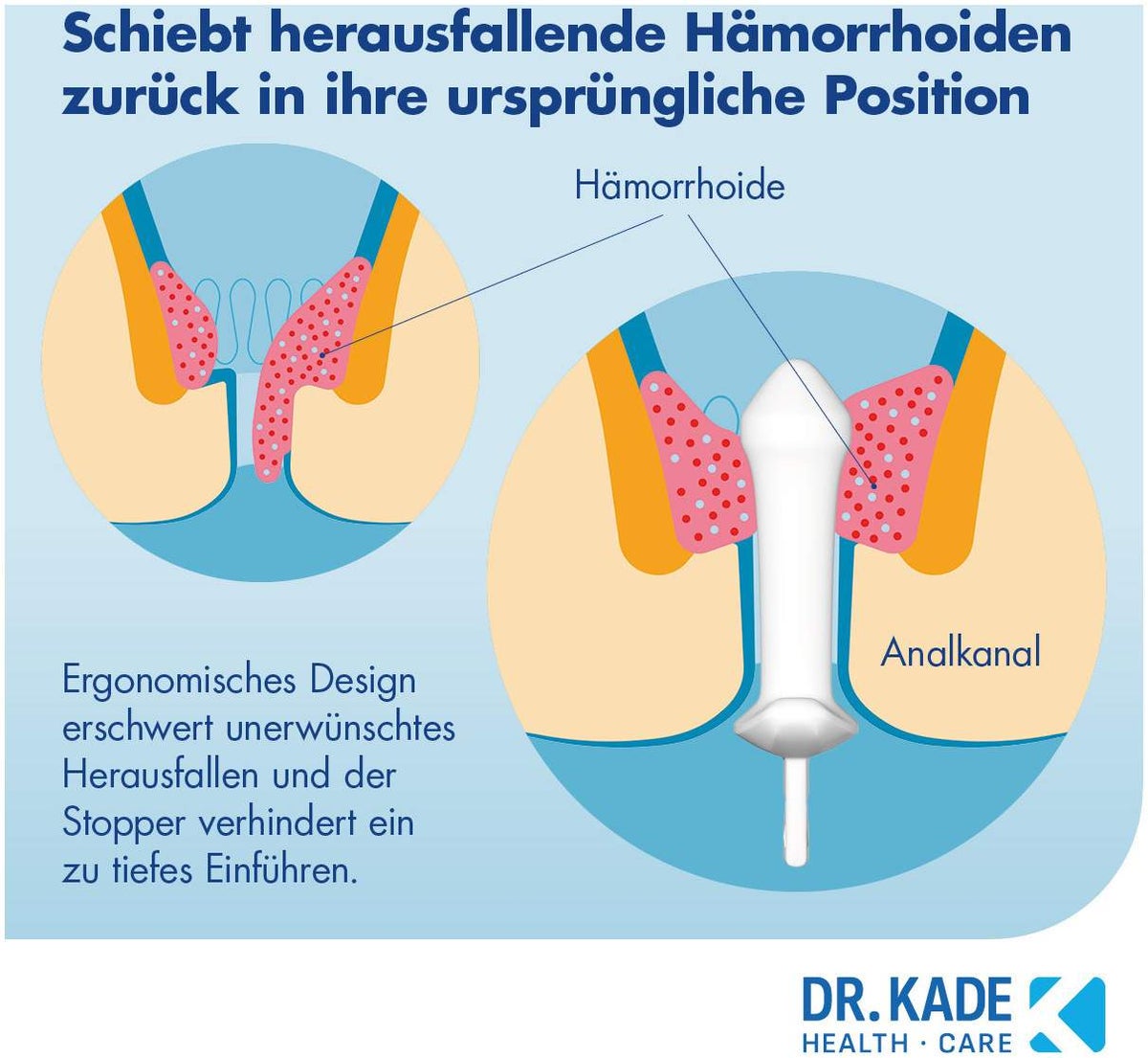 Postericare Hämorrhoiden-Stick 1 Stück