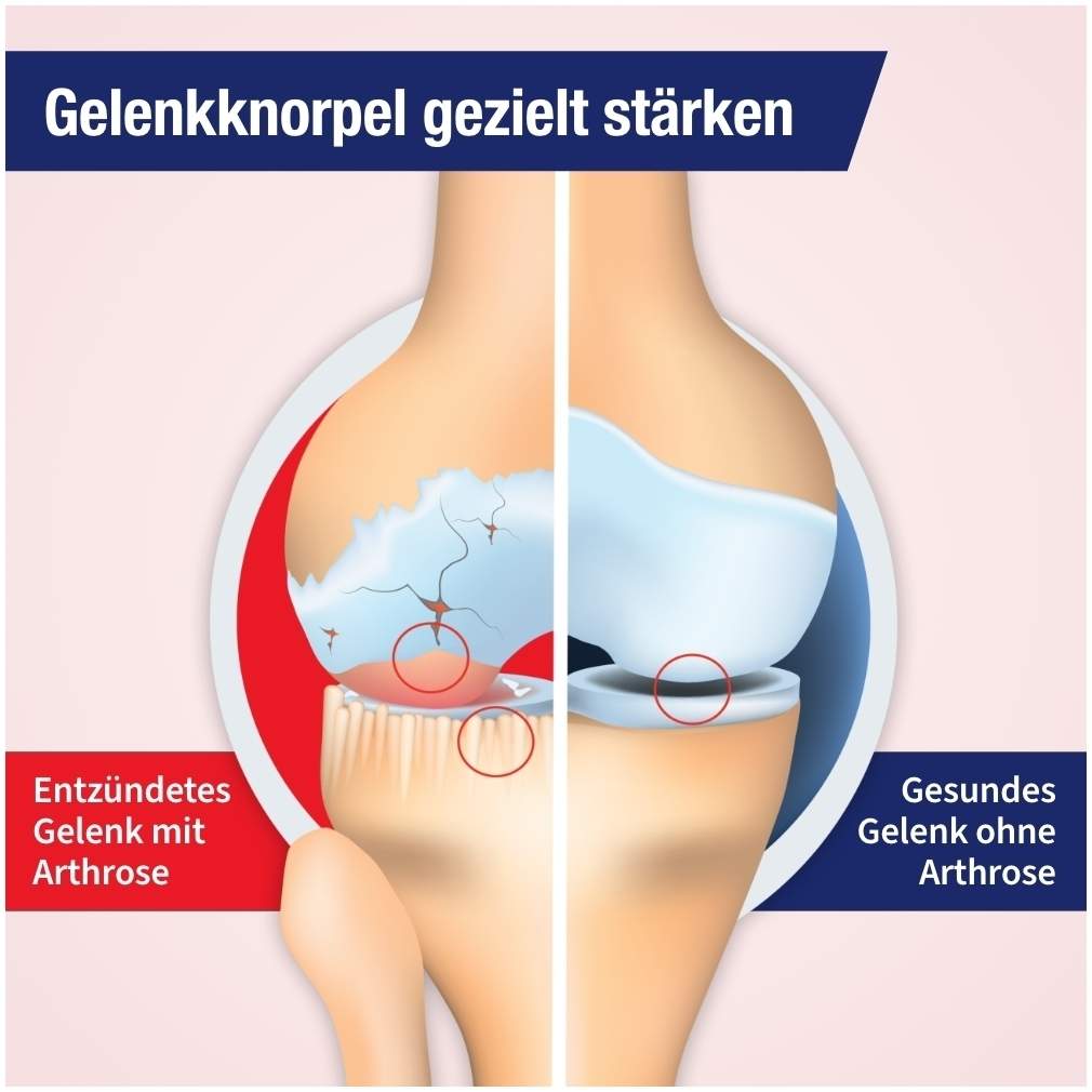 Gelencium Arthro Tropfen zum Einnehmen 50 ml