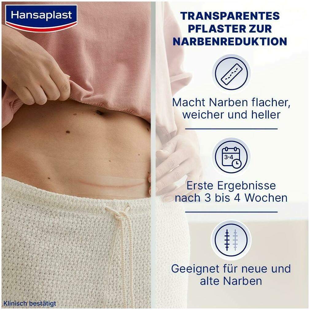 Hansaplast Pflaster Narben Reduktion Xl 3 cm X 14,6 cm 21 Stück