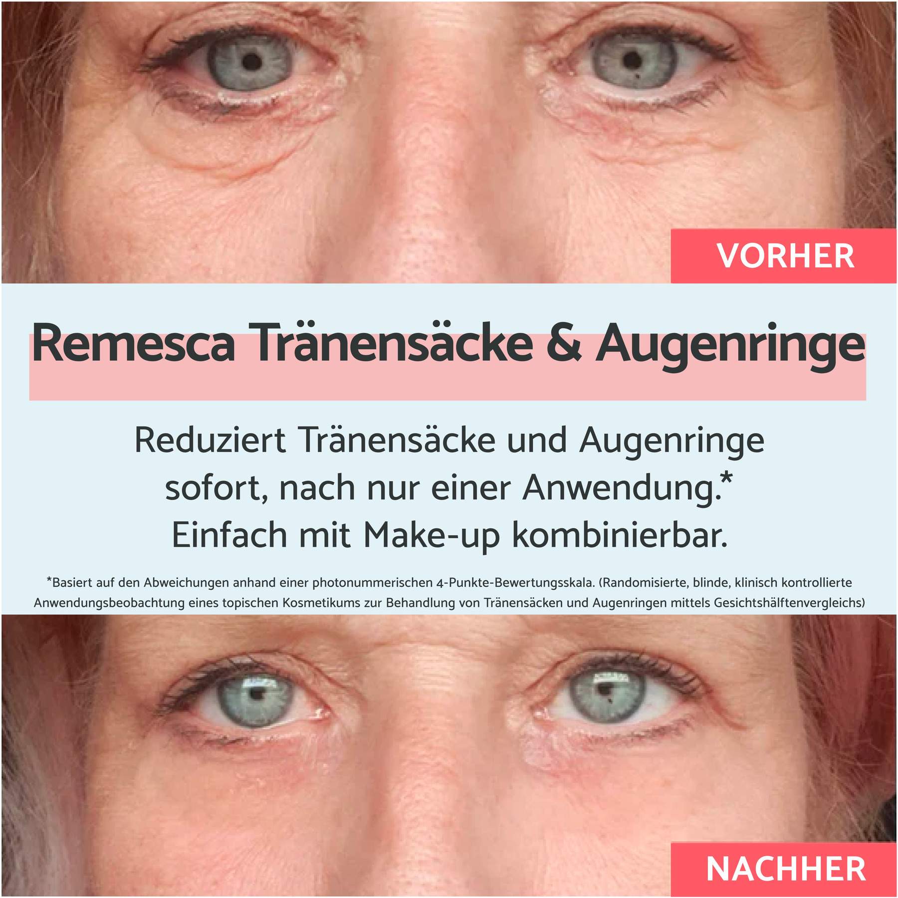 Remescar Tränensäcke und Augenringe Augencreme 8 ml