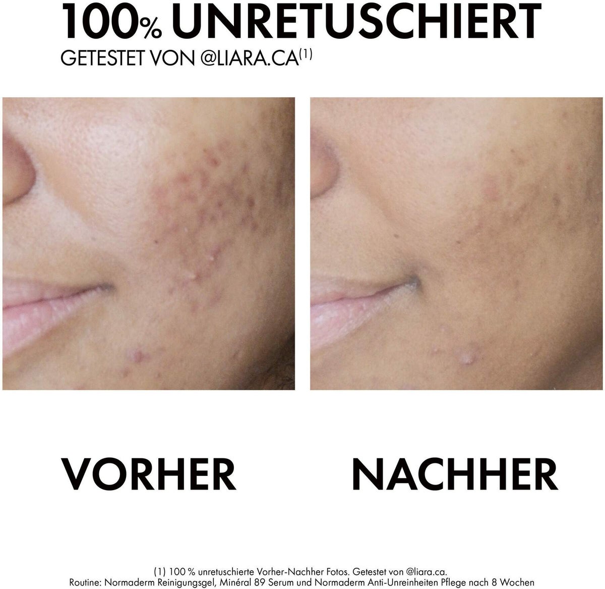 Vichy Normaderm Phytosolution Anti Unreinheitenpflege mit 2 Fach Wirkung 50 ml
