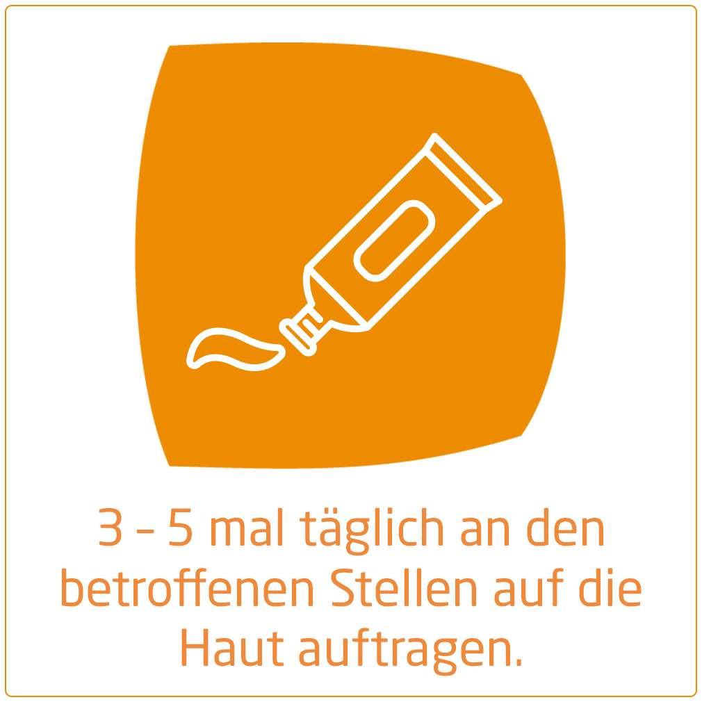 Weleda Arnika-Salbe 30% 70g Salbe