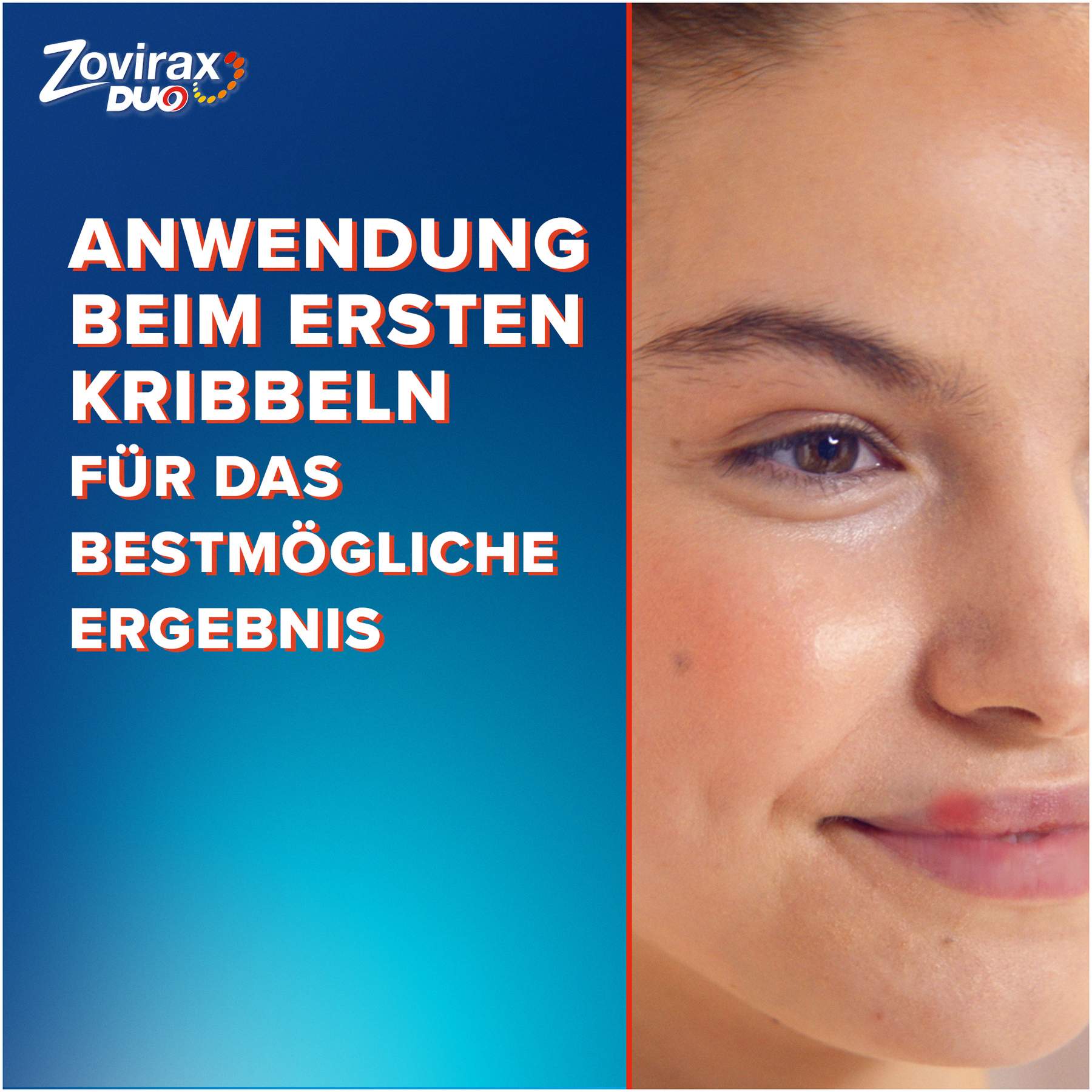 Zovirax Duo 50 mg je g und 10 mg je g 2 g Creme