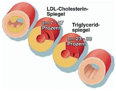 Zimt plus Tabletten mit Chrom & Zink