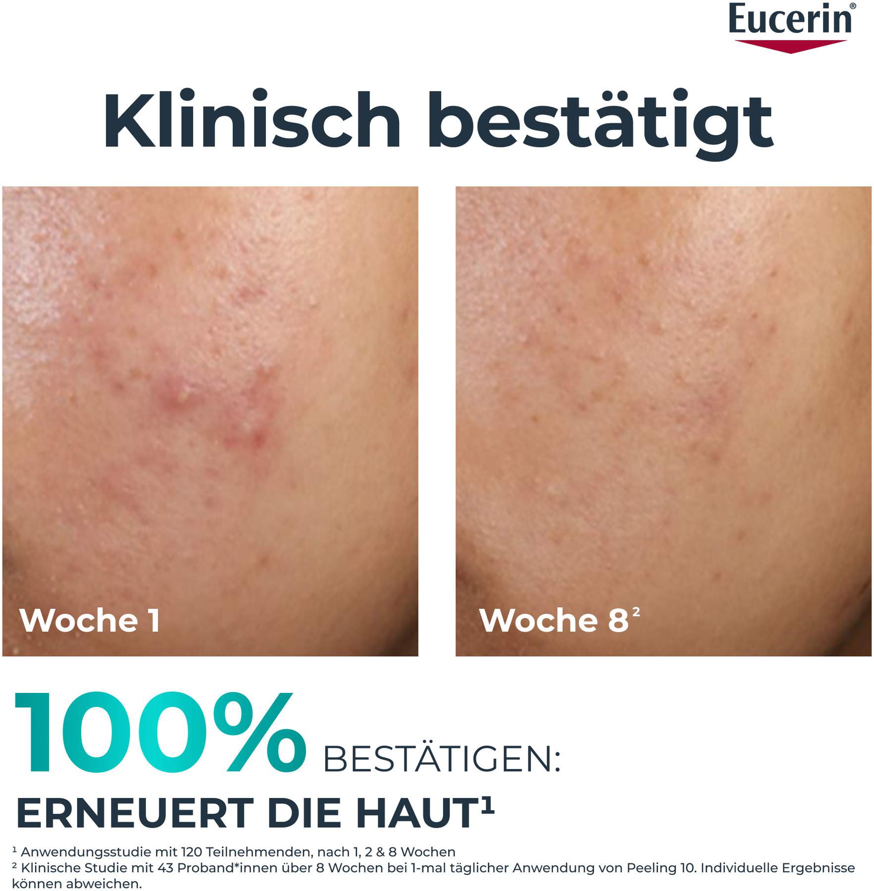 Eucerin DermoPure Clinical Peeling 10 40 ml