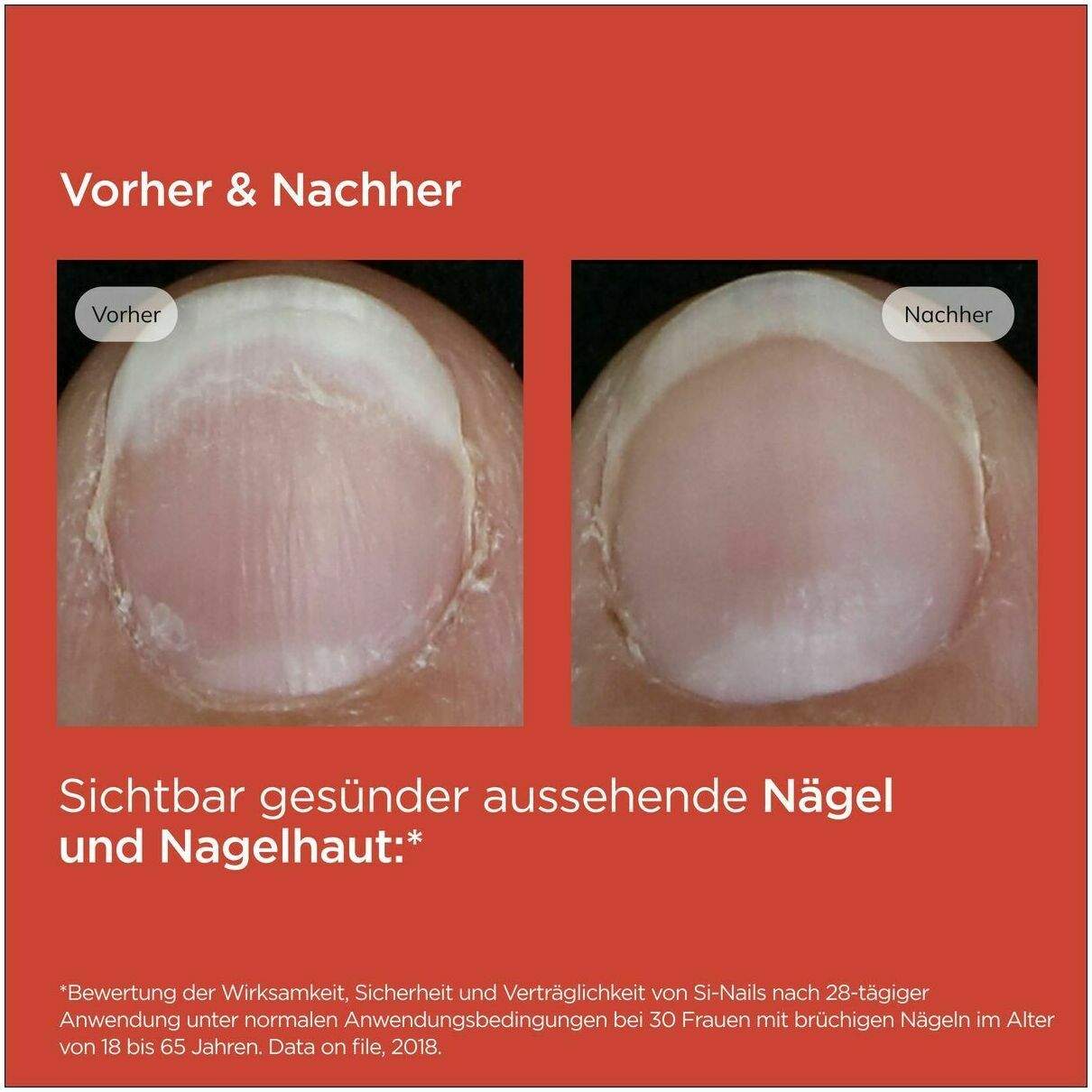 Isdin Si-Nails Nagelhärter Stift 2,5 ml