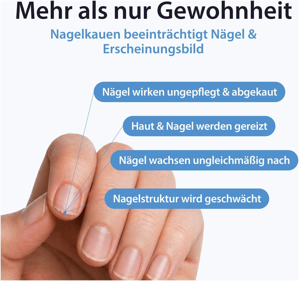 Acetocaustin Stift gegen Nägelkauen 3 ml