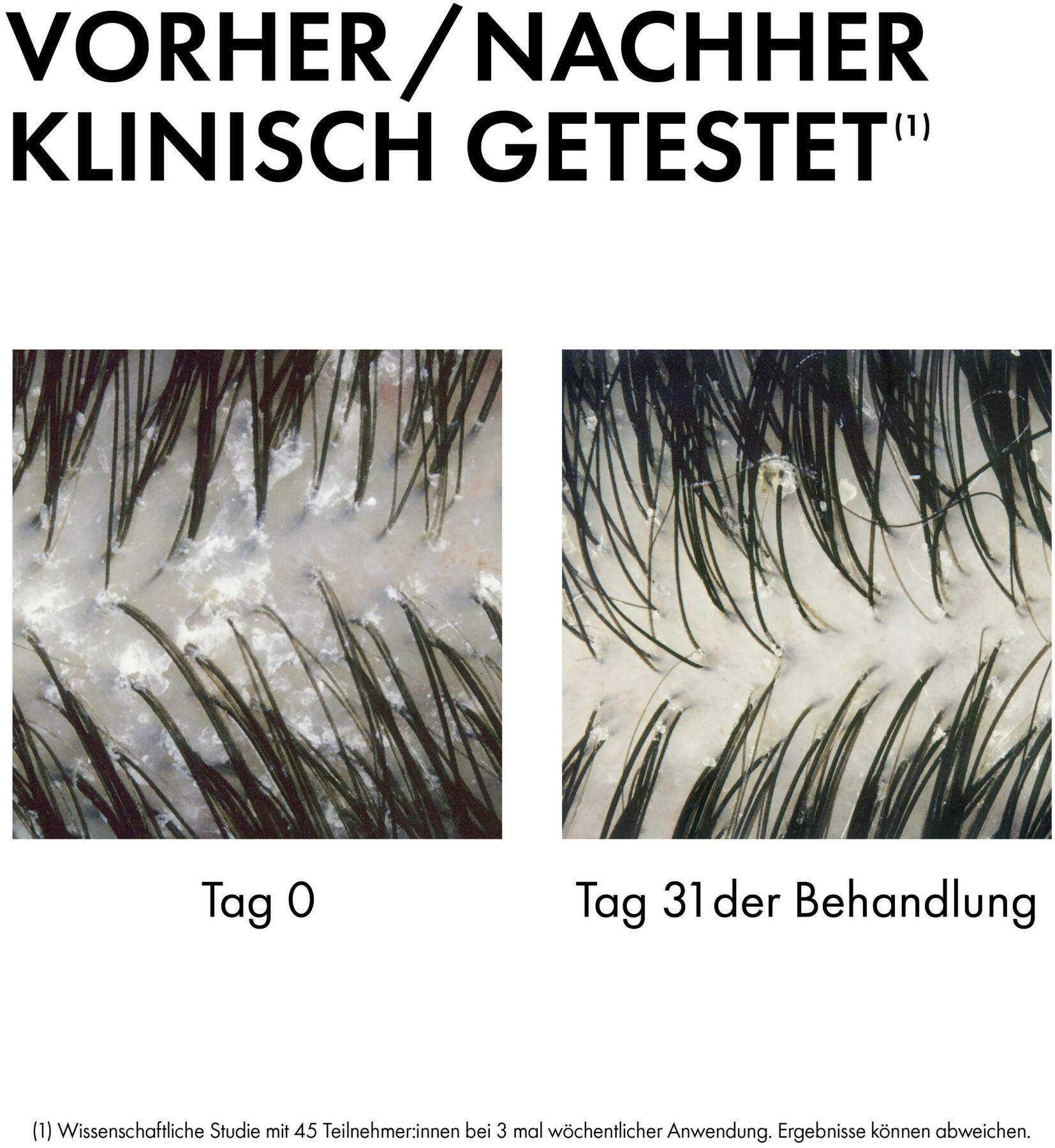 Vichy Dercos Anti-Schuppen 2in1 Shampoo + Conditioner 390 ml