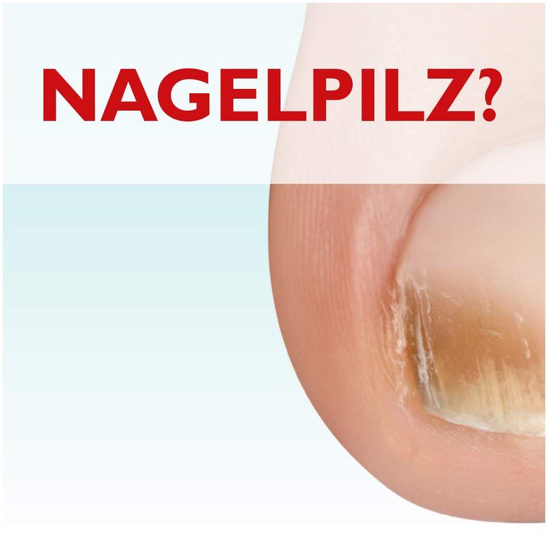 Miclast 80 mg pro g wirkstoffhaltiger Nagellack 3 ml