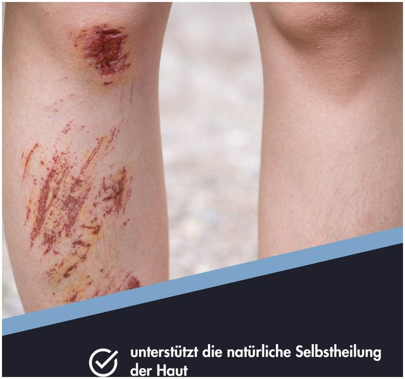 Zinksalbe Ensbona 75 ml
