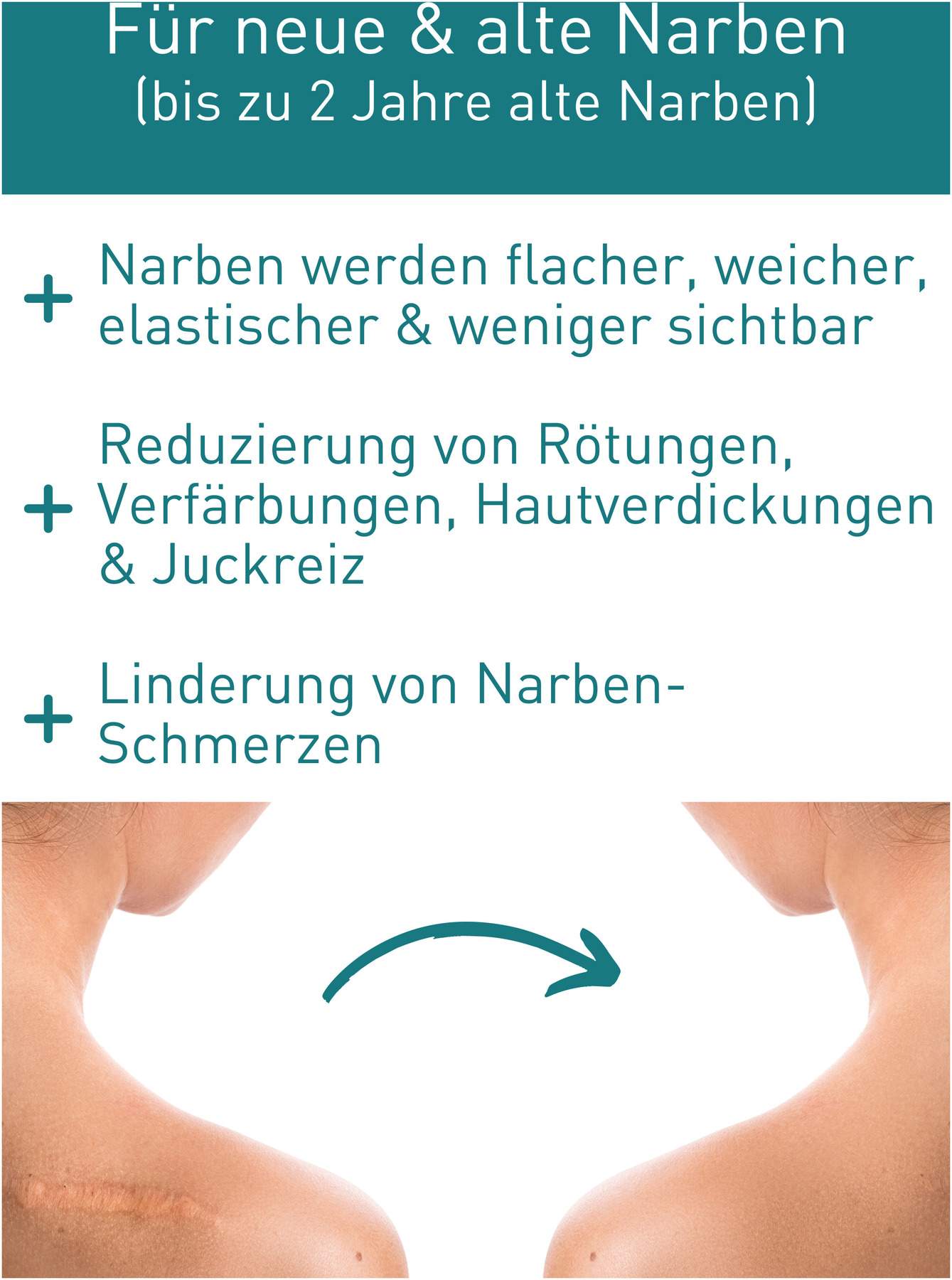N1 Narben Gel 19 G