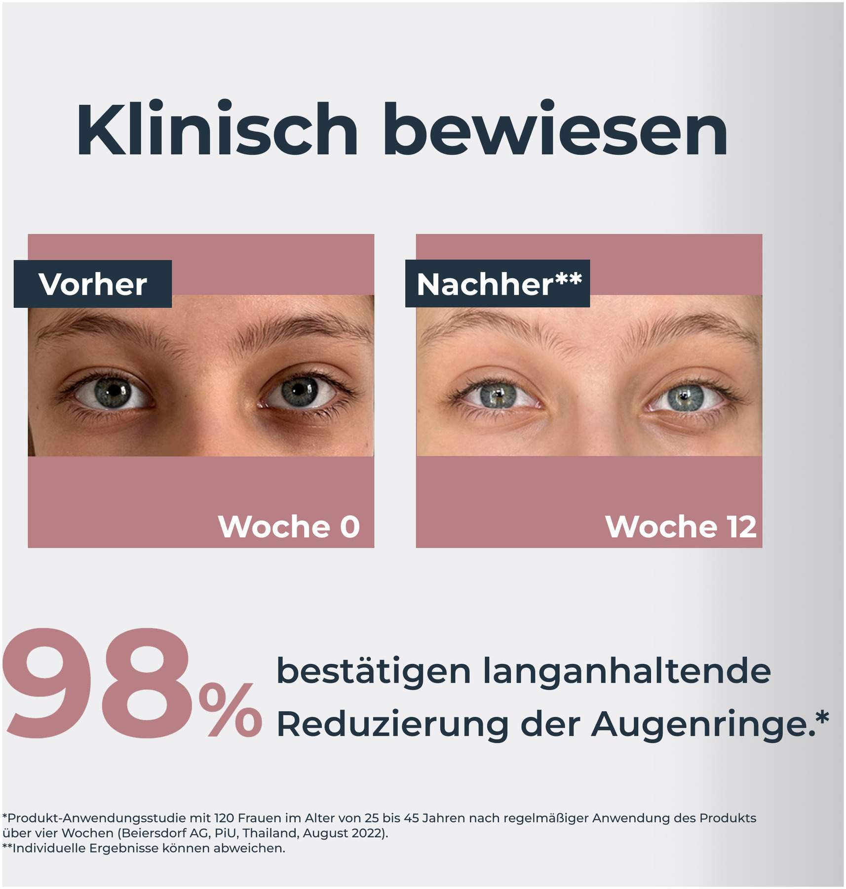 Eucerin Anti-Pigment Augenpflege Augenringe 15 ml