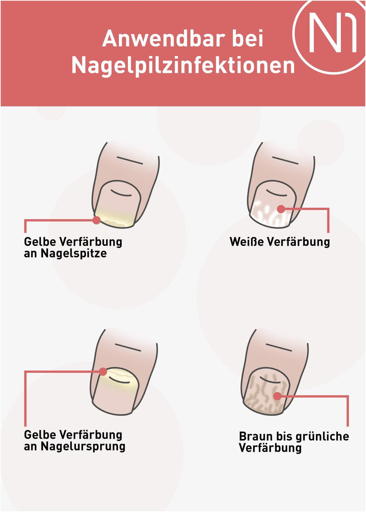 N1 Nagelpilz Lösung 10 ml
