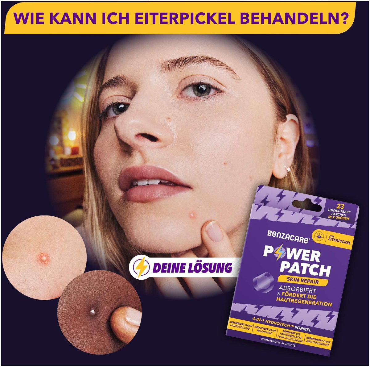 Benzacare Power Patch Skin Repair 23 Pflaster