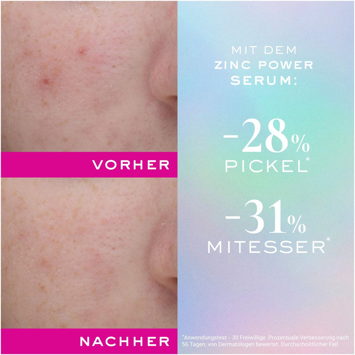NUXE Zinc Power Serum 30 ml
