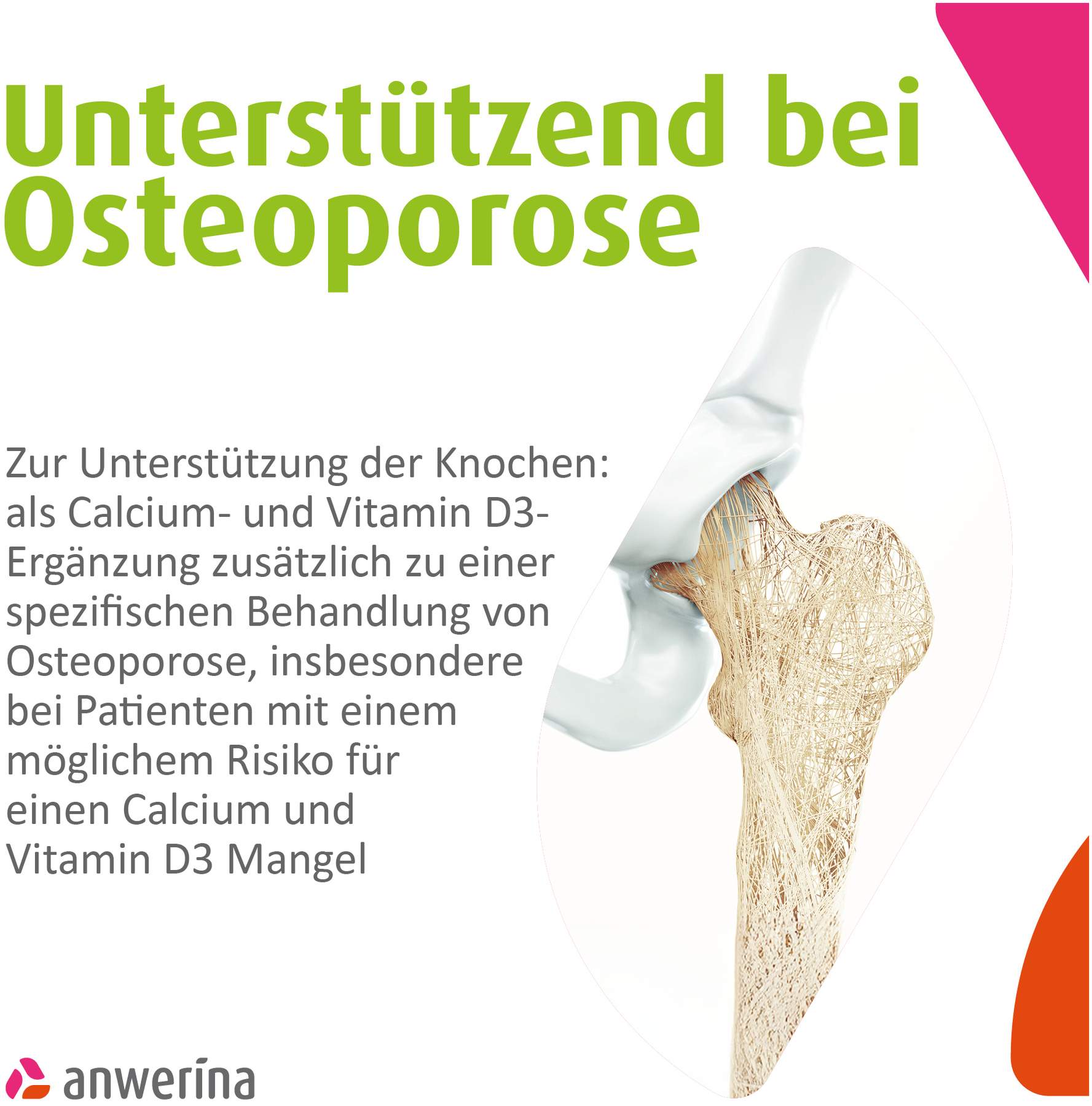 OsteoStix 500 mg-1000 I.E. Direktgranulat Beutel 60 Stück