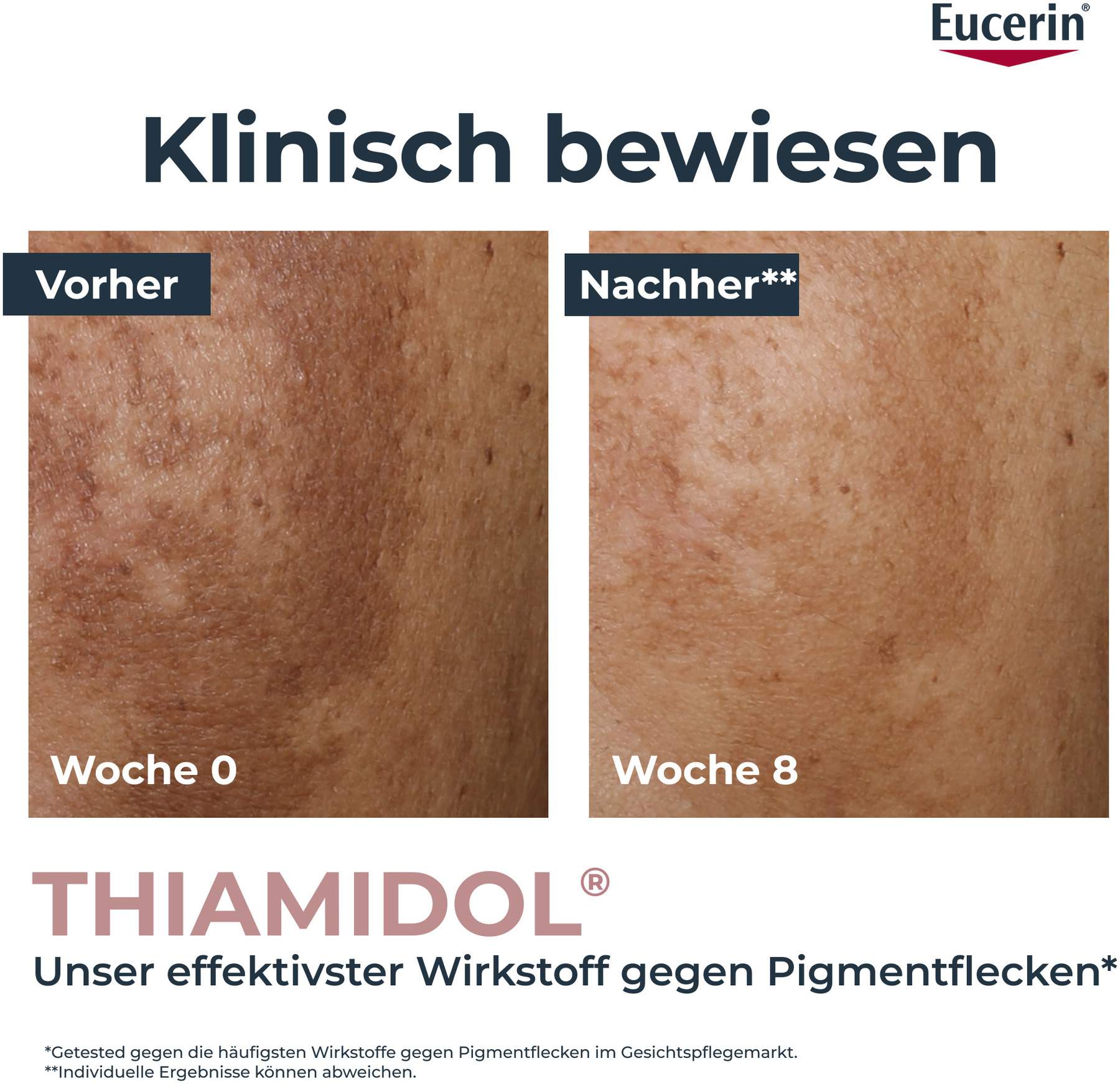 Eucerin Anti-Pigment Teint Perfektionierendes Serum 30 ml