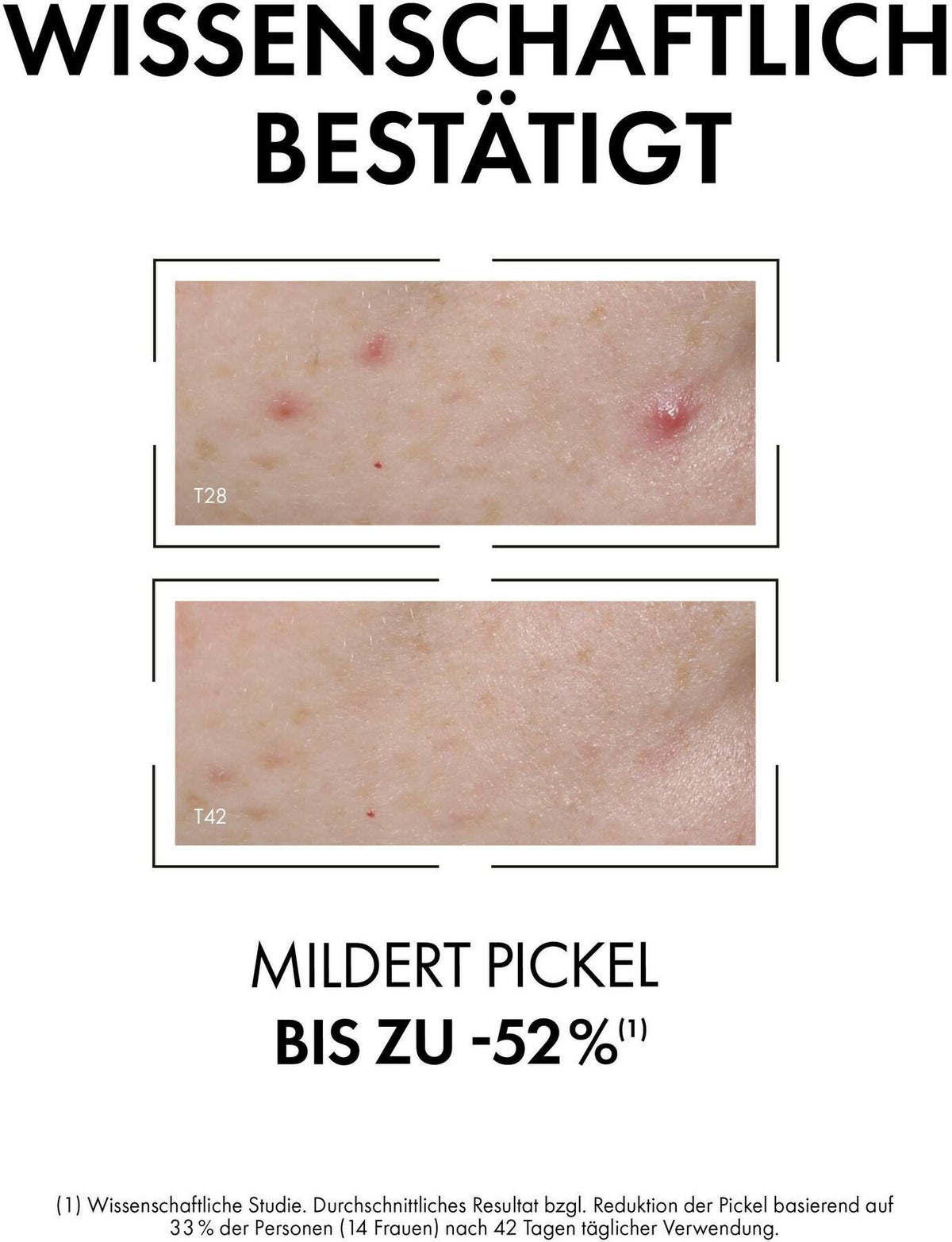 Vichy Normaderm Anti-Unreinheiten 30 ml Serum