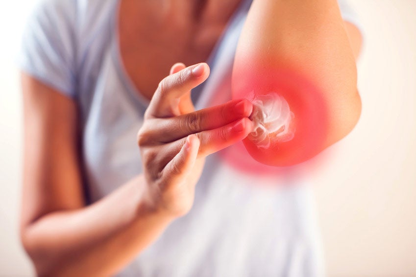 Voltaren Alternative: Ersatz-Produkte im Check