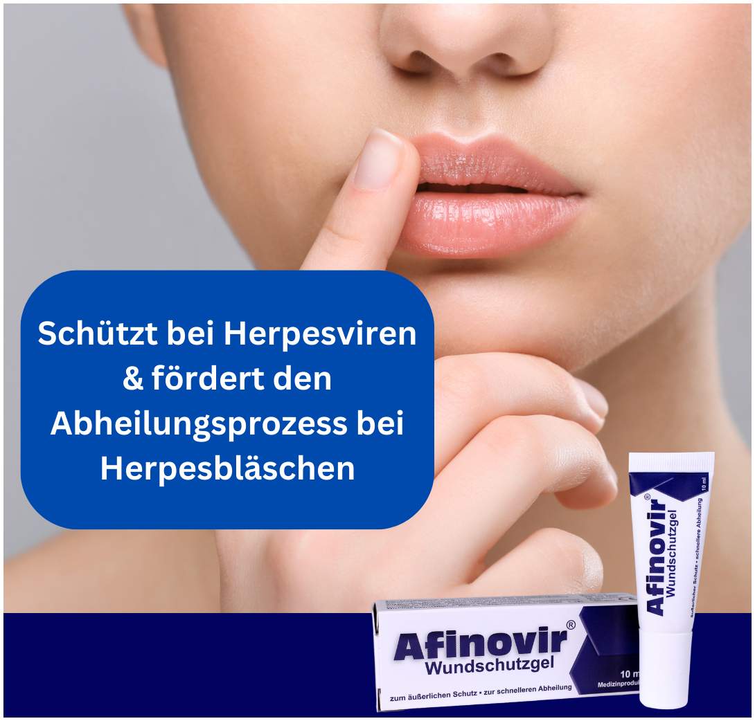 Afinovir Wundschutzgel 10 ml