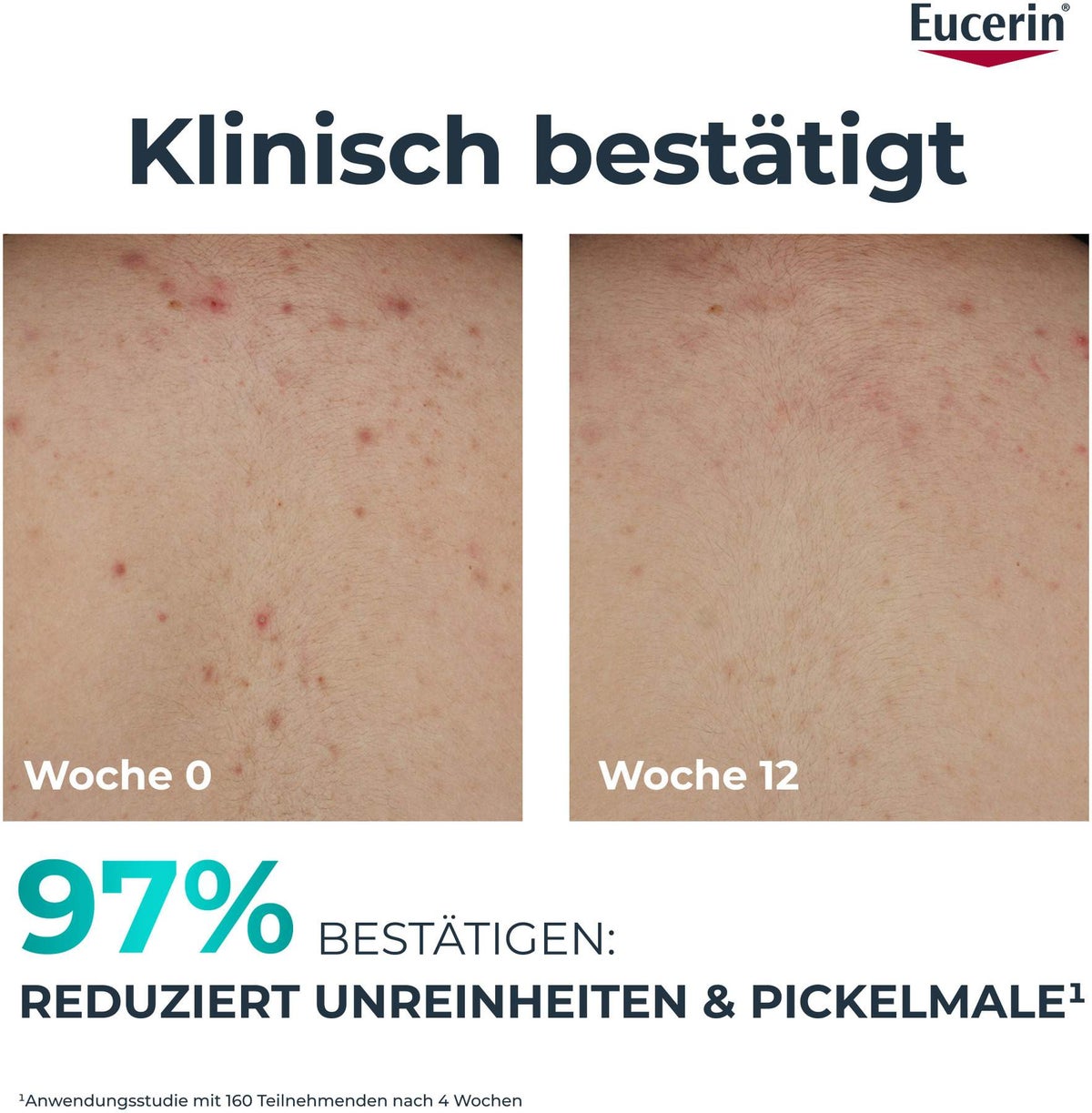 Eucerin DermoPure Clinical erneuernde Körperpflege 200 ml