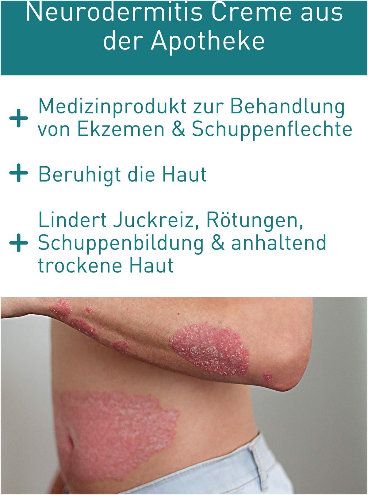 N1 Psoriasis Intensivcreme 50 ml