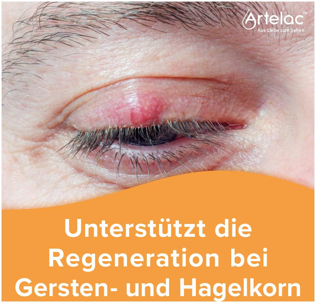 Artelac Augenlidhelfer Salbe 15 g