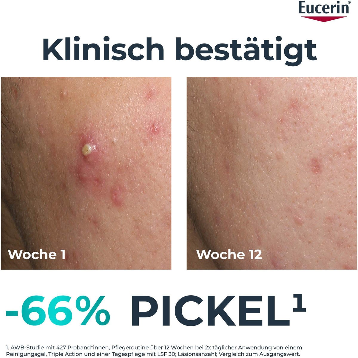 Eucerin DermoPure Clinical Triple Action 40 ml