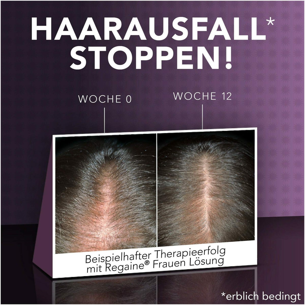 Regaine Frauen Lösung 3 x 60 ml