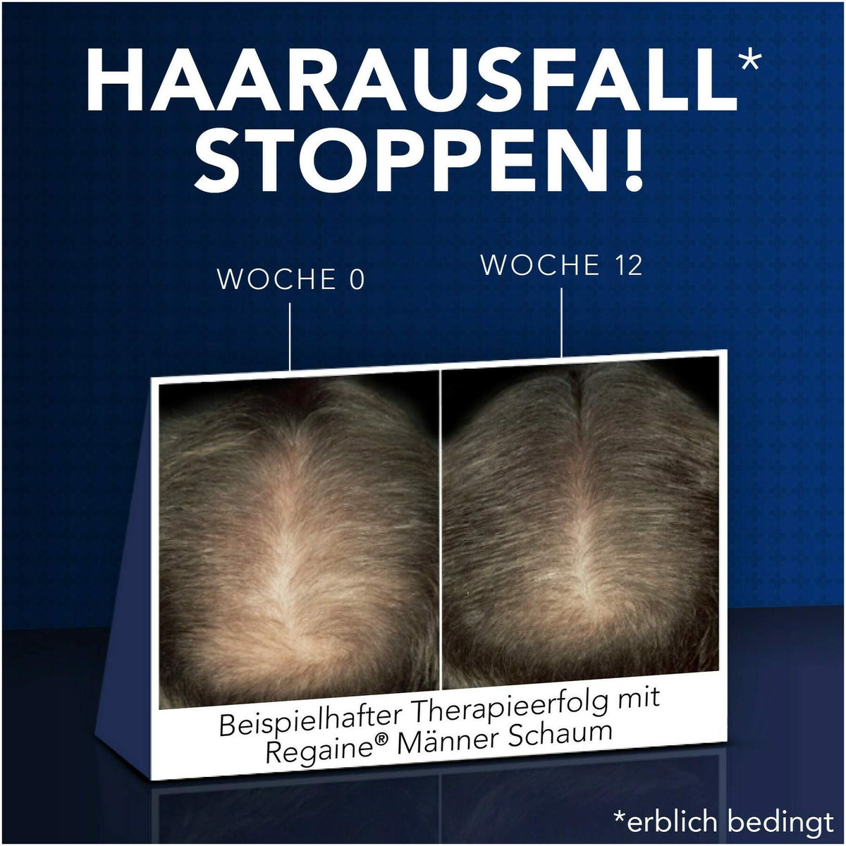 Regaine Männer 3 x 60 ml Lösung