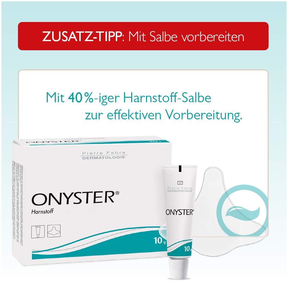 Miclast 80 mg pro g wirkstoffhaltiger Nagellack 3 ml
