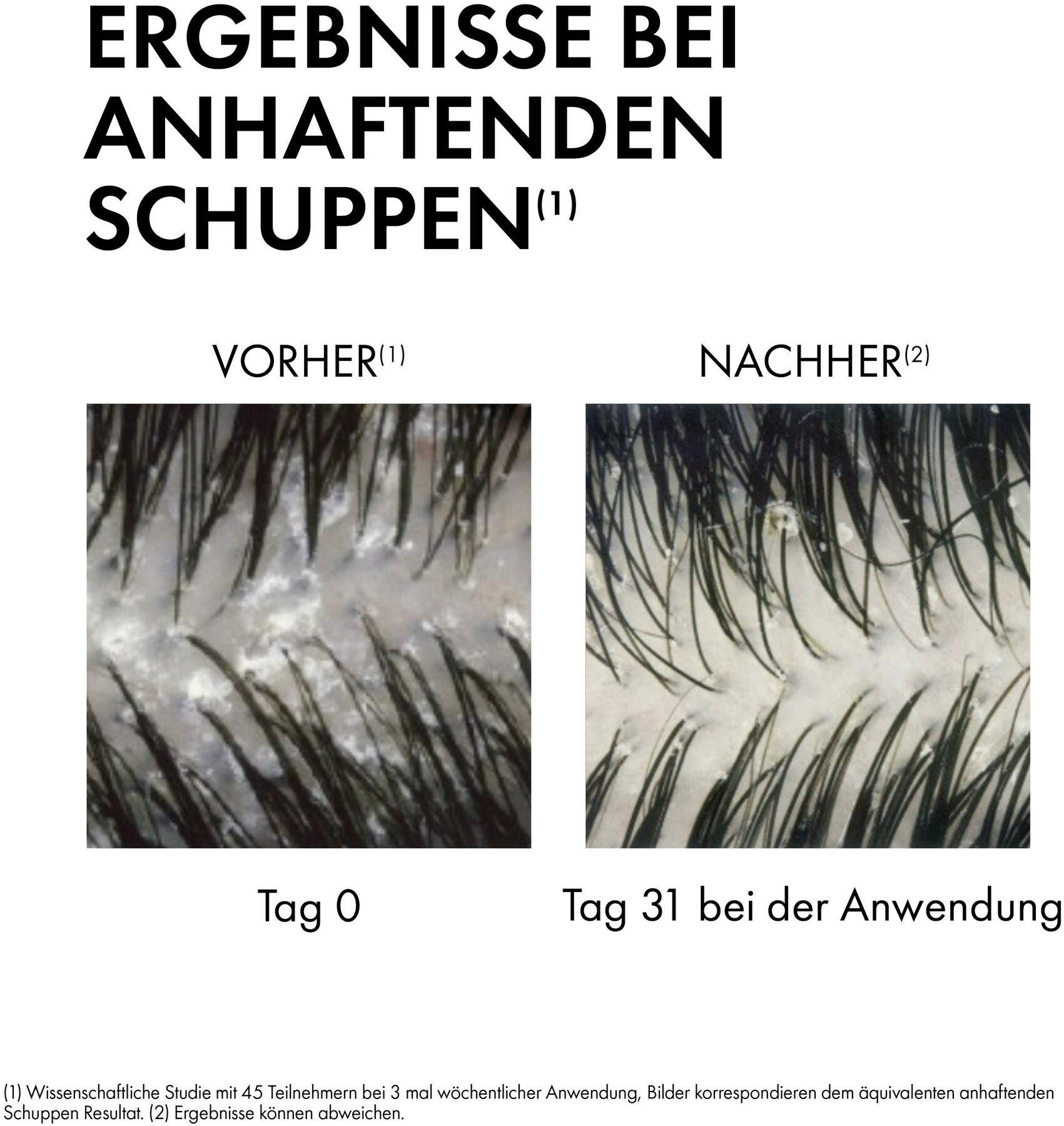 Vichy Dercos Anti-Schuppen Shampoo für trockene Kopfhaut 200 ml