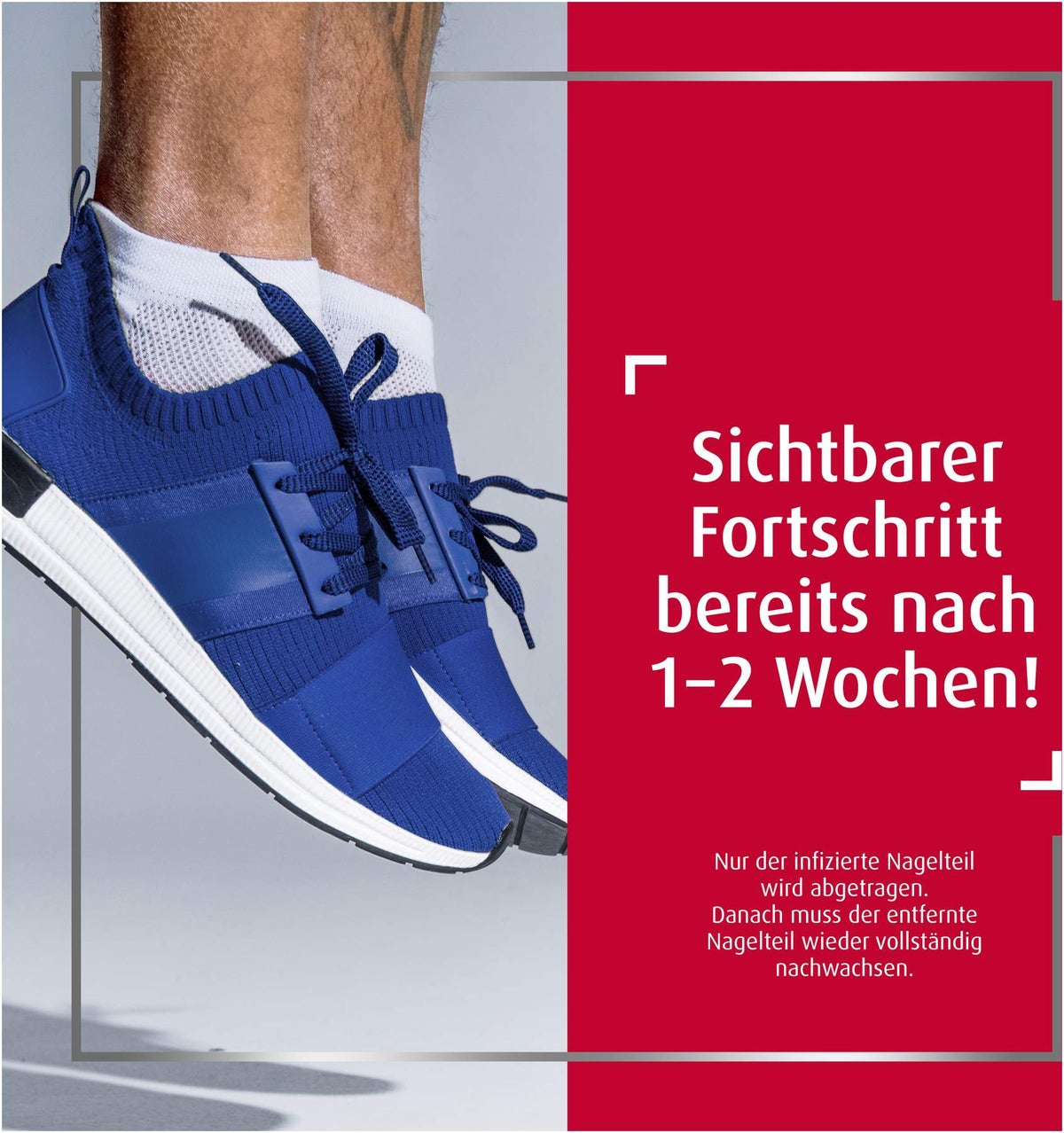 Sparset Canesten Extra Nagelset + Canesten Extra 20 g Creme
