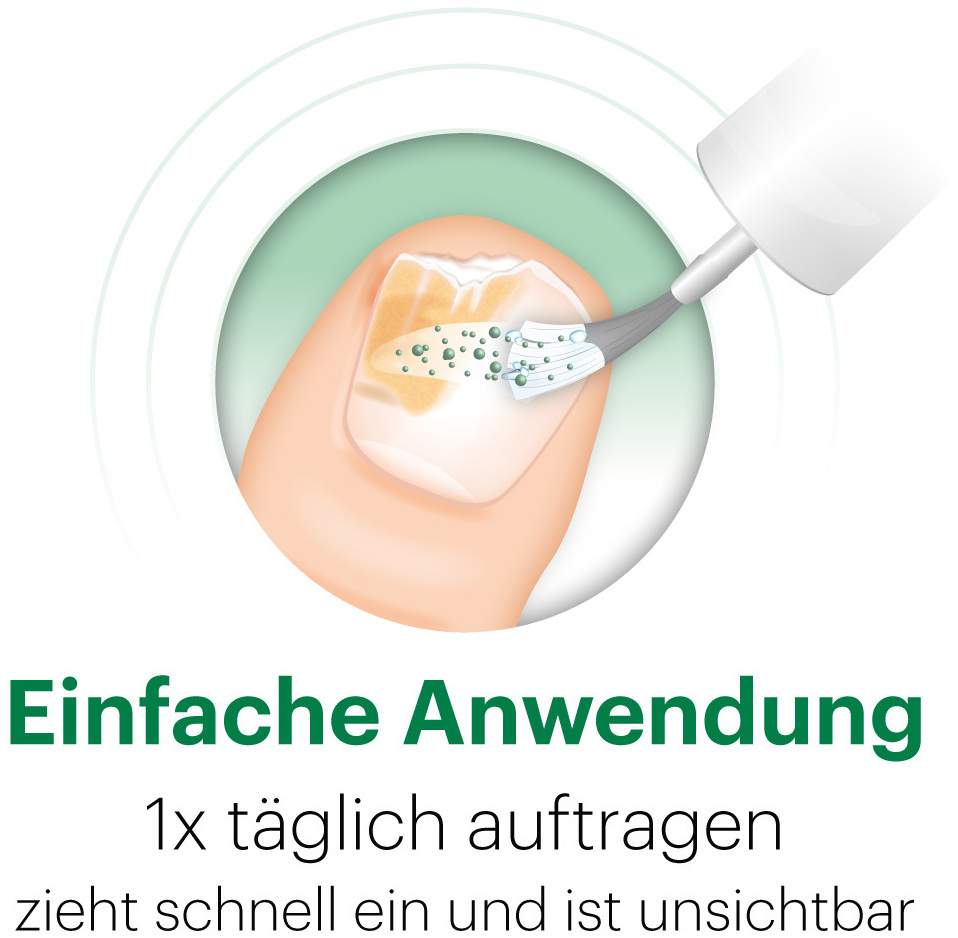Ciclopoli gegen Nagelpilz 6,6 ml