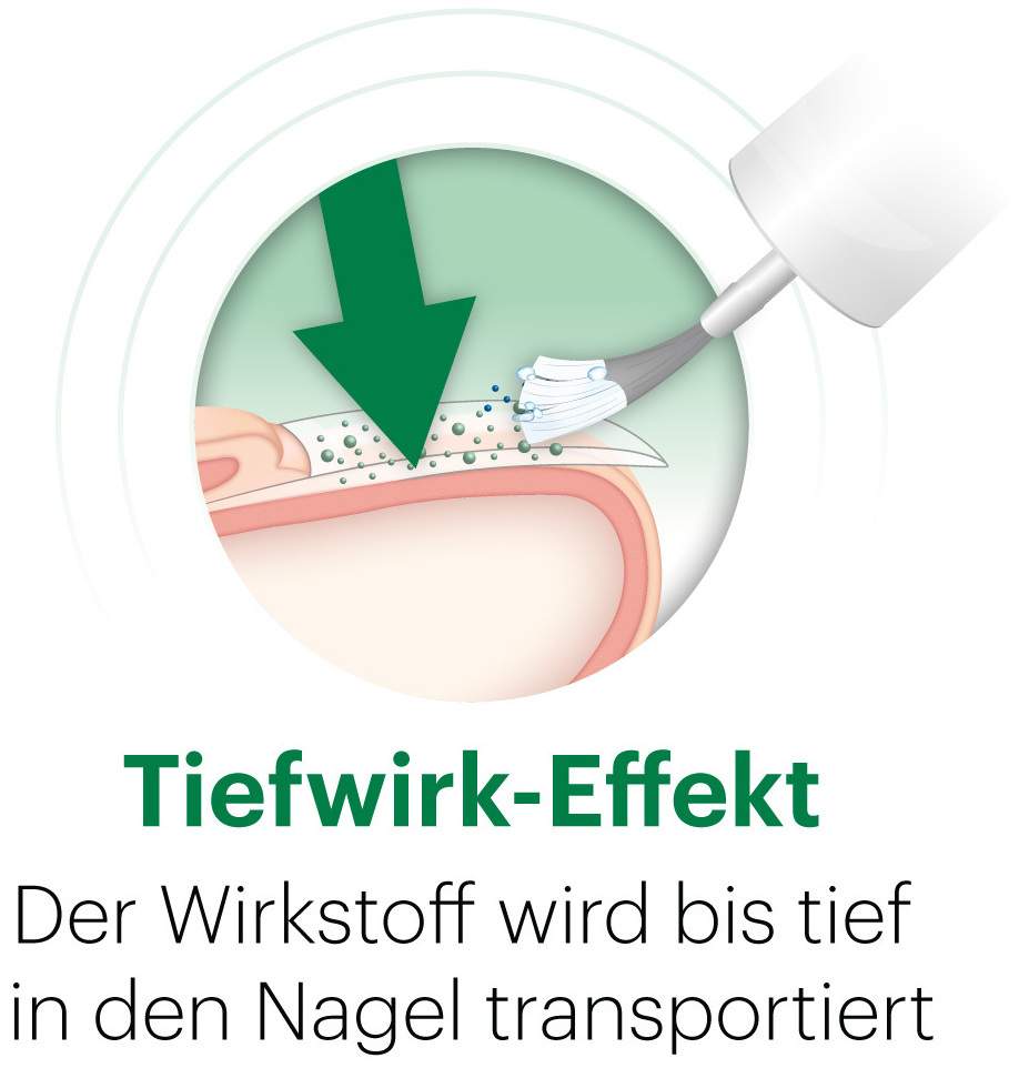 Ciclopoli gegen Nagelpilz 6,6 ml