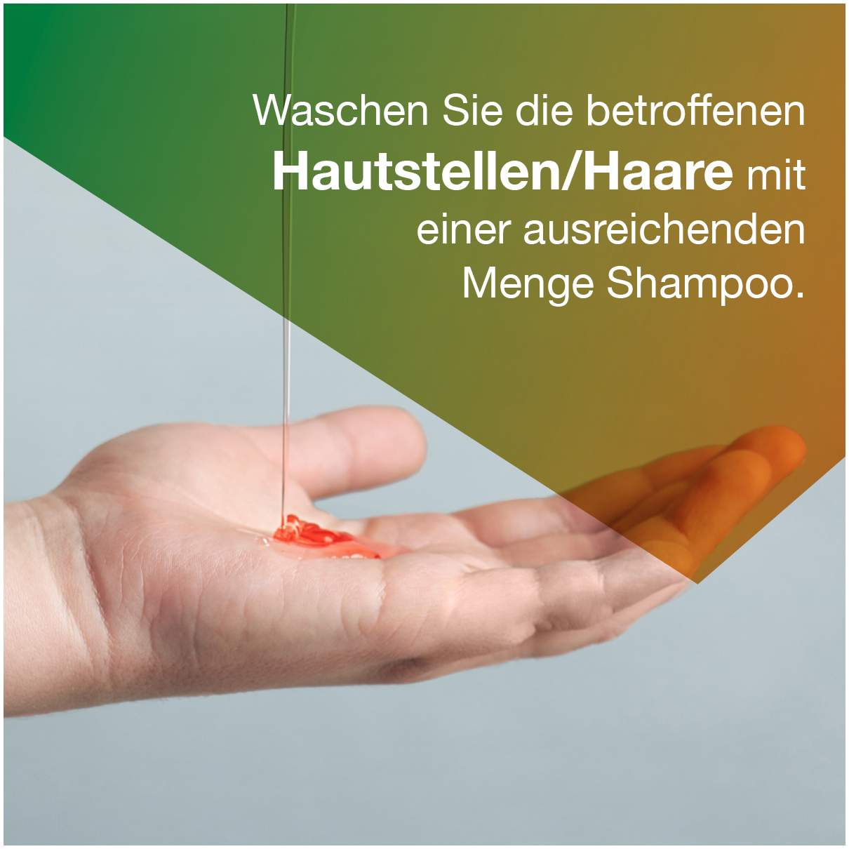 Ketozolin 2 % Shampoo 120 ml